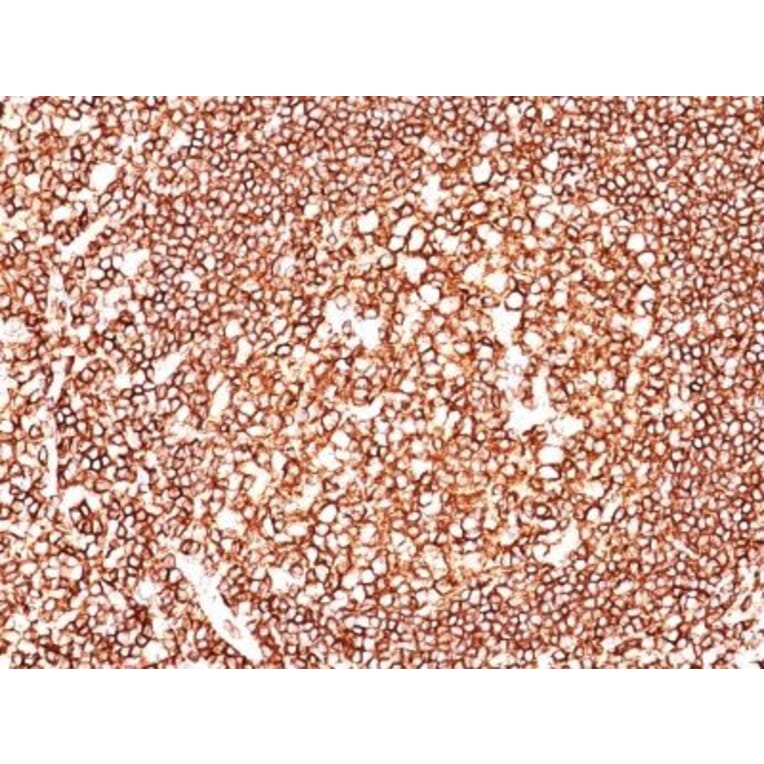 Immunohistochemistry (formalin-fixed, paraffin-embedded) - Anti-CD45 Antibody [135-4C5] (CF®680R) (A352251) - Antibodies.com
