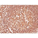 Immunohistochemistry (formalin-fixed, paraffin-embedded) - Anti-CD45 Antibody [135-4C5] (CF®680R) (A352251) - Antibodies.com