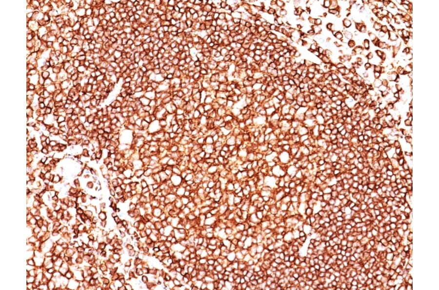 Immunohistochemistry (formalin-fixed, paraffin-embedded) - Anti-CD45 Antibody [136-4B5] (CF®647) (A352257) - Antibodies.com