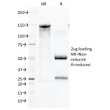 SDS-PAGE - Anti-CD45 Antibody [136-4B5] (CF®594) (A352261) - Antibodies.com