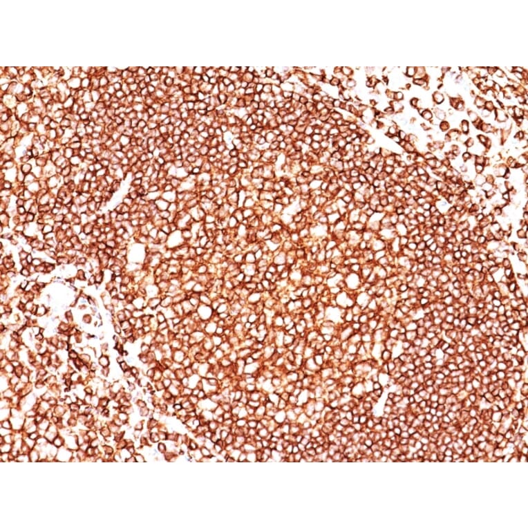 Immunohistochemistry (formalin-fixed, paraffin-embedded) - Anti-CD45 Antibody [136-4B5] (Biotin) (A352262) - Antibodies.com
