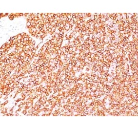 Immunohistochemistry (formalin-fixed, paraffin-embedded) - Anti-CD45RB Antibody [BRA-11G] (CF®647) (A352265) - Antibodies.com