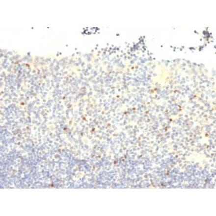 Immunohistochemistry (formalin-fixed, paraffin-embedded) - Anti-FOXP3 Antibody [FXP3/197] (CF®405S) (A352287) - Antibodies.com