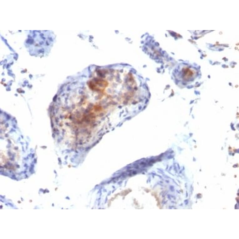 Immunohistochemistry (formalin-fixed, paraffin-embedded) - Anti-FOXP3 Antibody [FXP3/197] (CF®405S) (A352287) - Antibodies.com