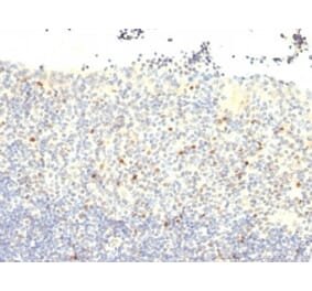 Immunohistochemistry (formalin-fixed, paraffin-embedded) - Anti-FOXP3 Antibody [FXP3/197] (CF®647) (A352289) - Antibodies.com