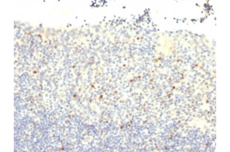 Immunohistochemistry (formalin-fixed, paraffin-embedded) - Anti-FOXP3 Antibody [FXP3/197] (CF®568) (A352290) - Antibodies.com