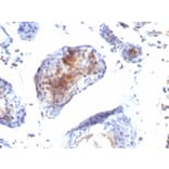 Immunohistochemistry (formalin-fixed, paraffin-embedded) - Anti-FOXP3 Antibody [FXP3/197] (CF®740) (A352291) - Antibodies.com