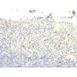 Immunohistochemistry (formalin-fixed, paraffin-embedded) - Anti-FOXP3 Antibody [FXP3/197] (CF®594) (A352293) - Antibodies.com