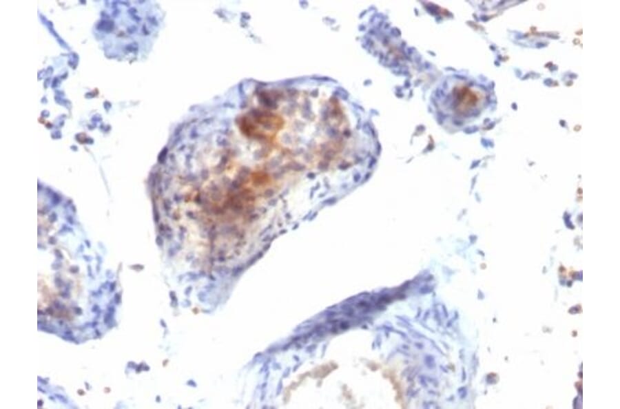 Immunohistochemistry (formalin-fixed, paraffin-embedded) - Anti-FOXP3 Antibody [FXP3/197] (CF®594) (A352293) - Antibodies.com