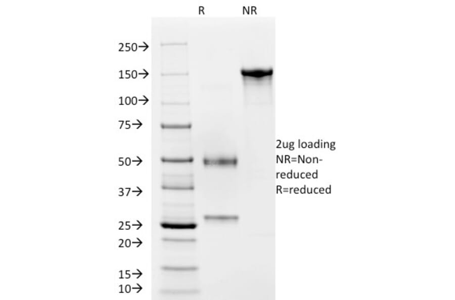 SDS-PAGE - Anti-CD4 Antibody [C4/206] (CF®740) (A352300) - Antibodies.com