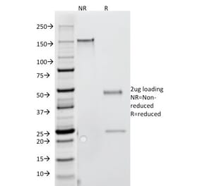 SDS-PAGE - Anti-IFN gamma Antibody [G-23] (CF®405S) (A352312) - Antibodies.com