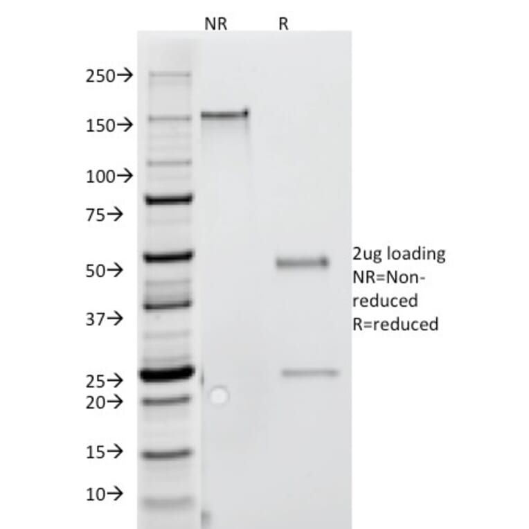 SDS-PAGE - Anti-IFN gamma Antibody [G-23] (CF®647) (A352314) - Antibodies.com