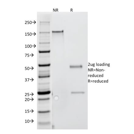 SDS-PAGE - Anti-IFN gamma Antibody [G-23] (CF®488A) (A352317) - Antibodies.com