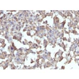 Immunohistochemistry (formalin-fixed, paraffin-embedded) - Anti-TLR4 Antibody [TLR4/230] (CF®405S) (A352320) - Antibodies.com