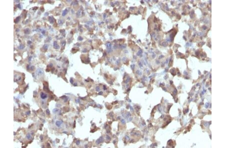Immunohistochemistry (formalin-fixed, paraffin-embedded) - Anti-TLR4 Antibody [TLR4/230] (CF®647) (A352322) - Antibodies.com