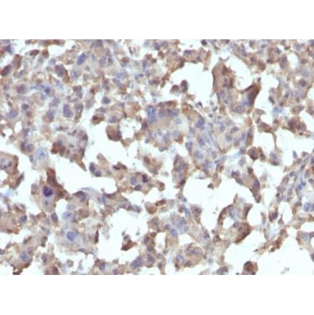Immunohistochemistry (formalin-fixed, paraffin-embedded) - Anti-TLR4 Antibody [TLR4/230] (CF®568) (A352323) - Antibodies.com
