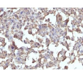 Immunohistochemistry (formalin-fixed, paraffin-embedded) - Anti-TLR4 Antibody [TLR4/230] (Biotin) (A352328) - Antibodies.com