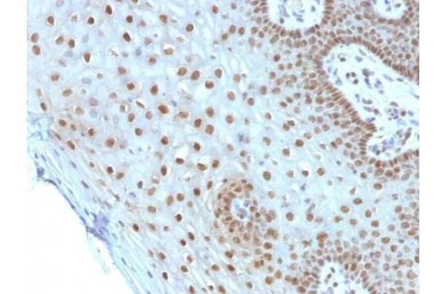 Immunohistochemistry (formalin-fixed, paraffin-embedded) - Anti-c-Myc Antibody [MYC275] (CF®640R) (A352346) - Antibodies.com