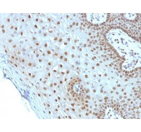 Immunohistochemistry (formalin-fixed, paraffin-embedded) - Anti-c-Myc Antibody [MYC275] (CF®568) (A352348) - Antibodies.com