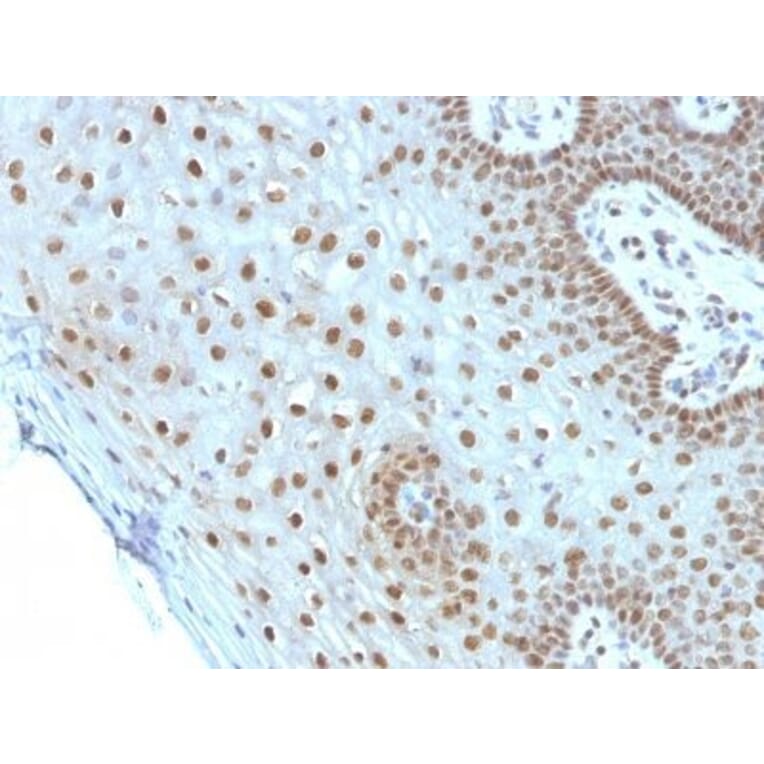 Immunohistochemistry (formalin-fixed, paraffin-embedded) - Anti-c-Myc Antibody [MYC275] (CF®568) (A352348) - Antibodies.com