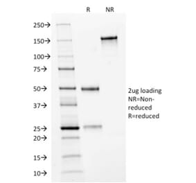 SDS-PAGE - Anti-ErbB2 Antibody [HRB2/282] (CF®640R) (A352362) - Antibodies.com