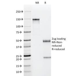 SDS-PAGE - Anti-p53 Antibody [PAb122] (CF®640R) (A352395) - Antibodies.com