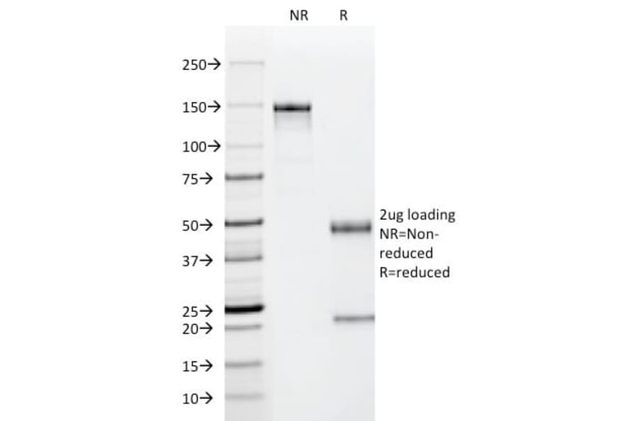 SDS-PAGE - Anti-p53 Antibody [PAb122] (CF®568) (A352397) - Antibodies.com