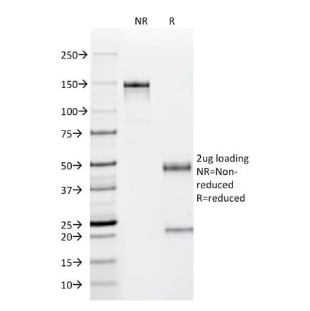 SDS-PAGE - Anti-p53 Antibody [PAb122] (CF®568) (A352397) - Antibodies.com