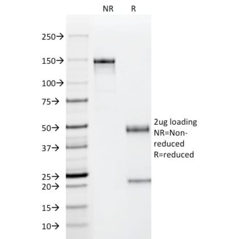 SDS-PAGE - Anti-p53 Antibody [PAb122] (CF®488A) (A352399) - Antibodies.com