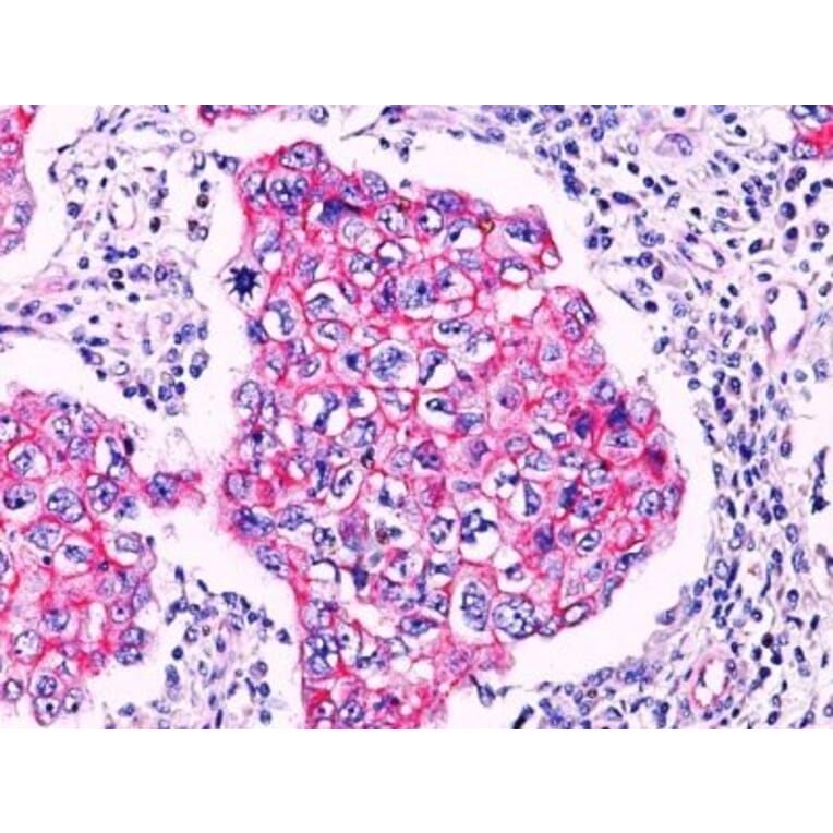 Immunohistochemistry (formalin-fixed, paraffin-embedded) - Anti-beta Catenin Antibody (CF®405S) (A352444) - Antibodies.com