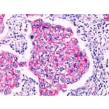 Immunohistochemistry (formalin-fixed, paraffin-embedded) - Anti-beta Catenin Antibody (CF®405S) (A352444) - Antibodies.com