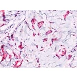 Immunohistochemistry (formalin-fixed, paraffin-embedded) - Anti-beta Catenin Antibody (CF®405S) (A352444) - Antibodies.com