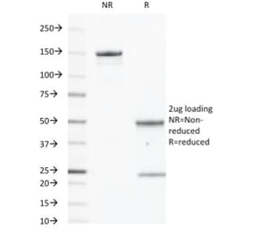 SDS-PAGE - Anti-EGFR Antibody [GFR450] (CF®405S) (A352516) - Antibodies.com