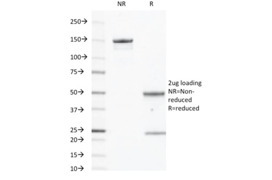 SDS-PAGE - Anti-EGFR Antibody [GFR450] (CF®405S) (A352516) - Antibodies.com