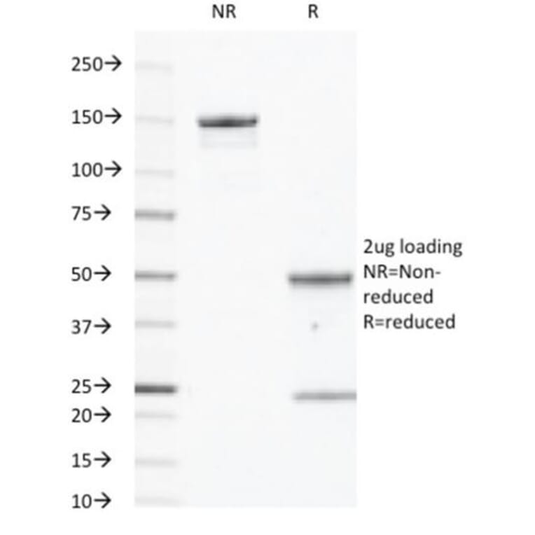 SDS-PAGE - Anti-EGFR Antibody [GFR450] (CF®405S) (A352516) - Antibodies.com