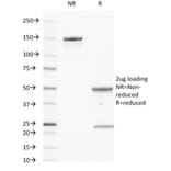 SDS-PAGE - Anti-EGFR Antibody [GFR450] (CF®405S) (A352516) - Antibodies.com