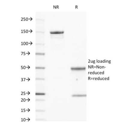 SDS-PAGE - Anti-EGFR Antibody [GFR450] (CF®488A) (A352521) - Antibodies.com