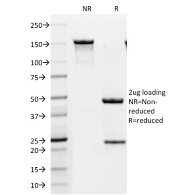 SDS-PAGE - Anti-ErbB2 Antibody [HRB2/451] (CF®405S) (A352524) - Antibodies.com