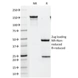 SDS-PAGE - Anti-ErbB2 Antibody [HRB2/451] (CF®405S) (A352524) - Antibodies.com