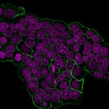 Immunofluorescence - Anti-ErbB2 Antibody [HRB2/451] (CF®640R) (A352525) - Antibodies.com
