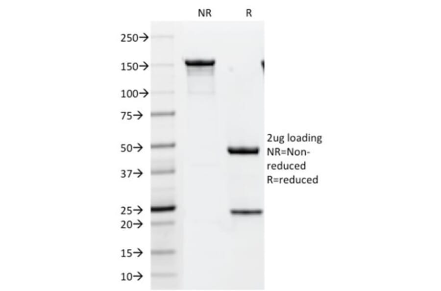 SDS-PAGE - Anti-ErbB2 Antibody [HRB2/451] (CF®640R) (A352525) - Antibodies.com