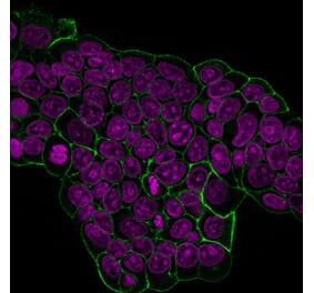 Immunofluorescence - Anti-ErbB2 Antibody [HRB2/451] (CF®740) (A352528) - Antibodies.com