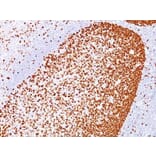 Immunohistochemistry (formalin-fixed, paraffin-embedded) - Anti-PCNA Antibody [PC10] (CF®568) (A352552) - Antibodies.com