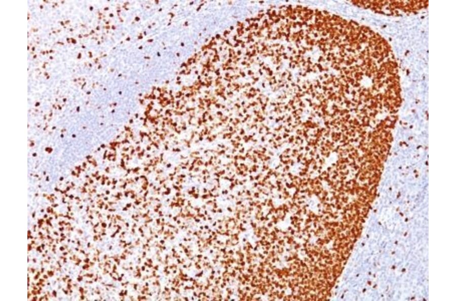 Immunohistochemistry (formalin-fixed, paraffin-embedded) - Anti-PCNA Antibody [PC10] (CF®488A) (A352554) - Antibodies.com