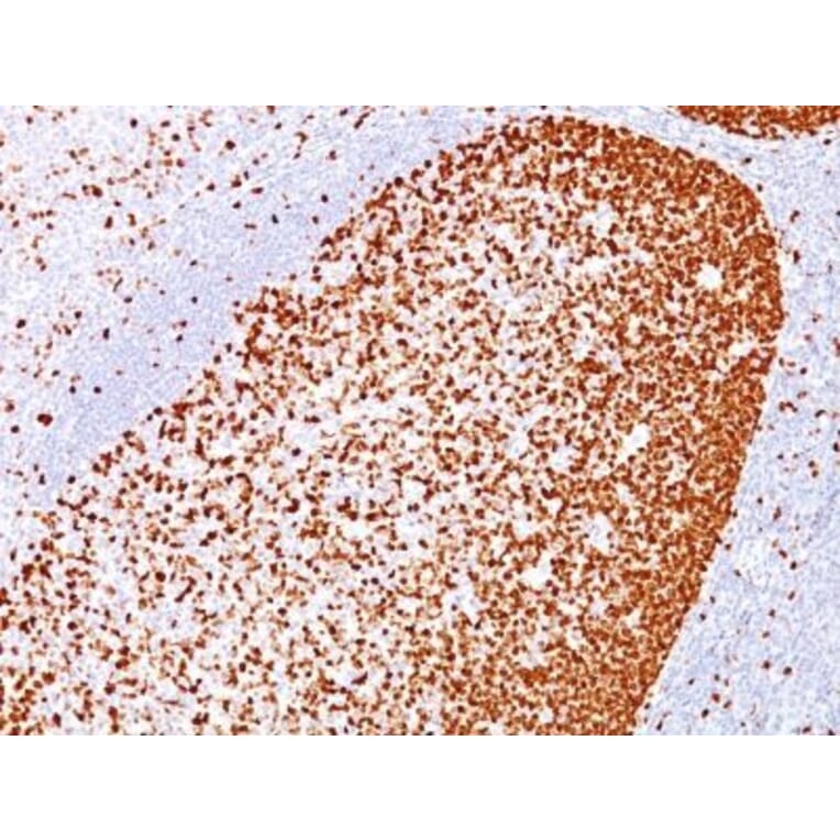 Immunohistochemistry (formalin-fixed, paraffin-embedded) - Anti-PCNA Antibody [PC10] (CF®488A) (A352554) - Antibodies.com