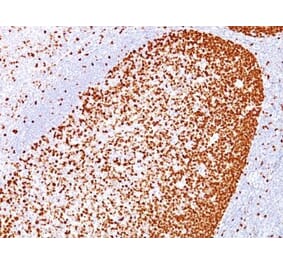 Immunohistochemistry (formalin-fixed, paraffin-embedded) - Anti-PCNA Antibody [PC10] (CF®594) (A352555) - Antibodies.com