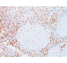 Immunohistochemistry (formalin-fixed, paraffin-embedded) - Anti-CD8 alpha Antibody [C8/468] (CF®405S) (A352557) - Antibodies.com