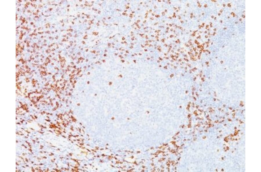 Immunohistochemistry (formalin-fixed, paraffin-embedded) - Anti-CD8 alpha Antibody [C8/468] (CF®405S) (A352557) - Antibodies.com