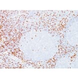 Immunohistochemistry (formalin-fixed, paraffin-embedded) - Anti-CD8 alpha Antibody [C8/468] (CF®568) (A352560) - Antibodies.com