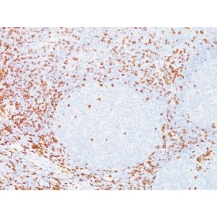 Immunohistochemistry (formalin-fixed, paraffin-embedded) - Anti-CD8 alpha Antibody [C8/468] (CF®488A) (A352562) - Antibodies.com
